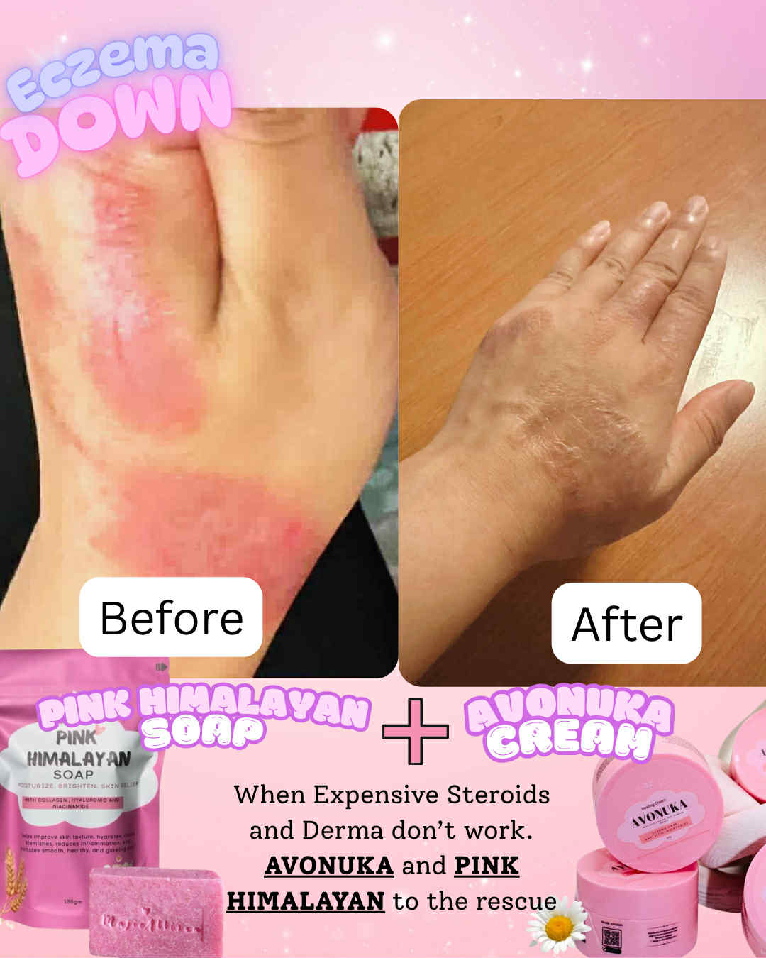 AVONUKA Emollient Cream jar for deep moisturization